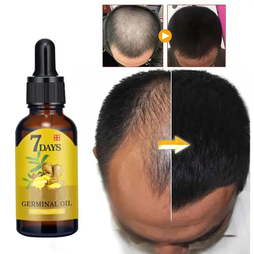 Hair Care Elseve - Huile essentielle de gingembre pour la