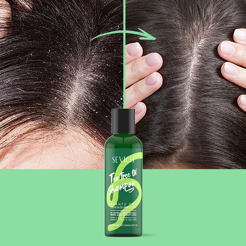 Shampoing à l'essence d'arbre  - Hair Care Essence avis et prix