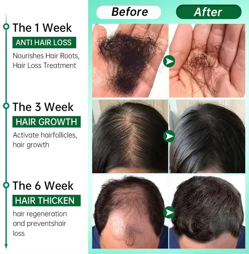 Sérum de croissance des cheveu - Hair Care Elseve avis et prix