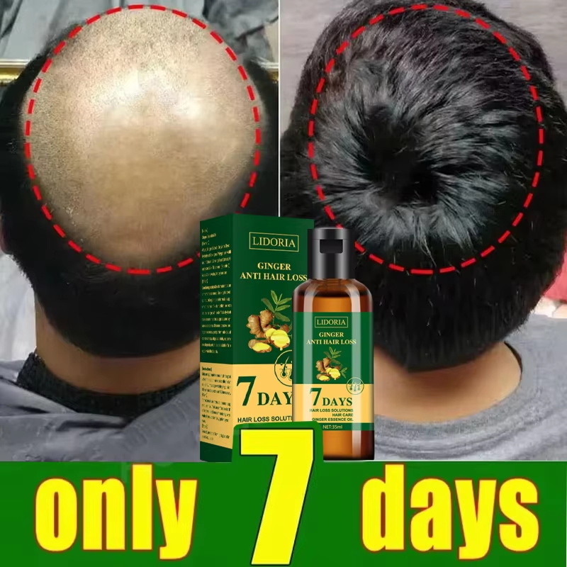 Sérum de croissance des cheveu - Hair Care Elseve avis et prix