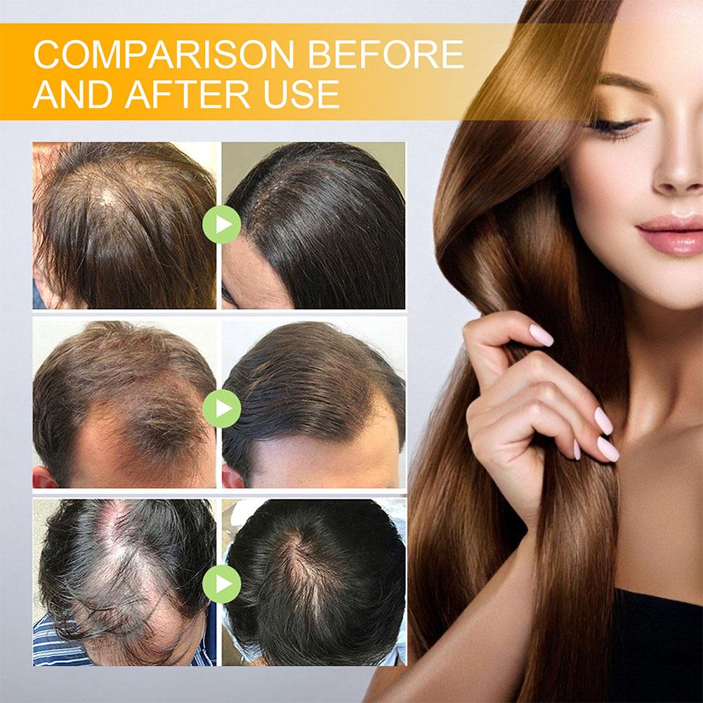 5/3/1 pièces biotine produits  - Hair Care Elseve avis et prix